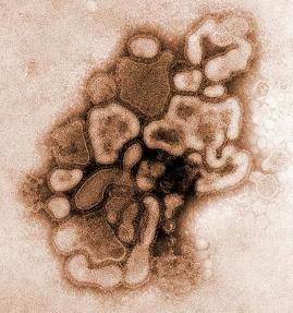 وفاة 4 أشخاص بعد تلقيهم لقاح انفلونزا الخنازير H1N1